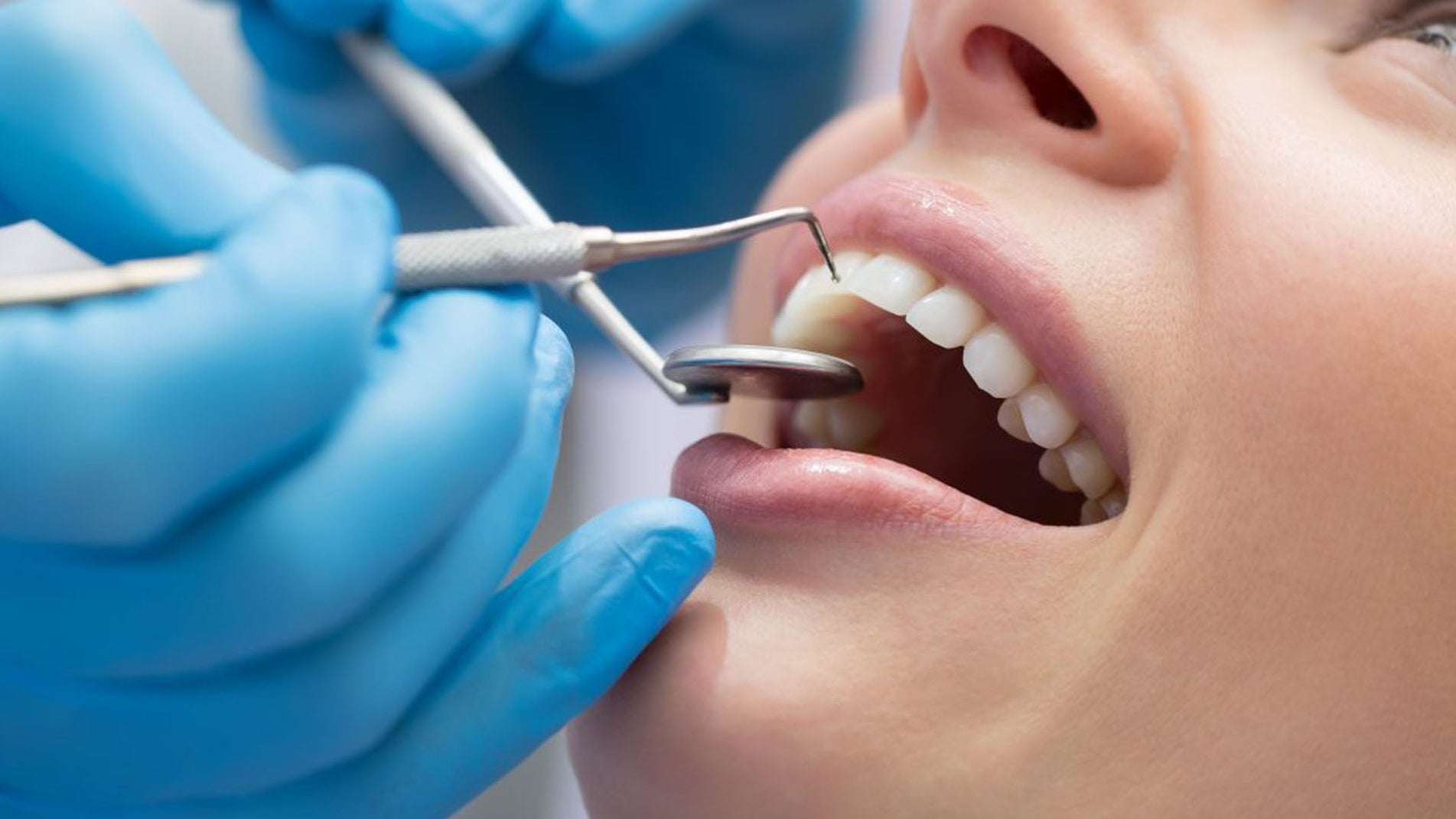 Yellow Teeth Se Pareshan? Paaiye Bright Smile Akyu Natural Ke Saath 🦷✨