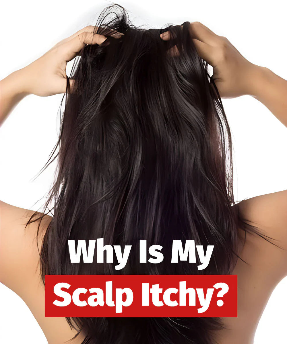 Why Is My Scalp Itchy? Causes, Remedies & Daily Care Tips